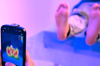 Saudi’s Amplifai Health Publishes World’s Largest AI Thermography Study For Diabetic Foot Detection